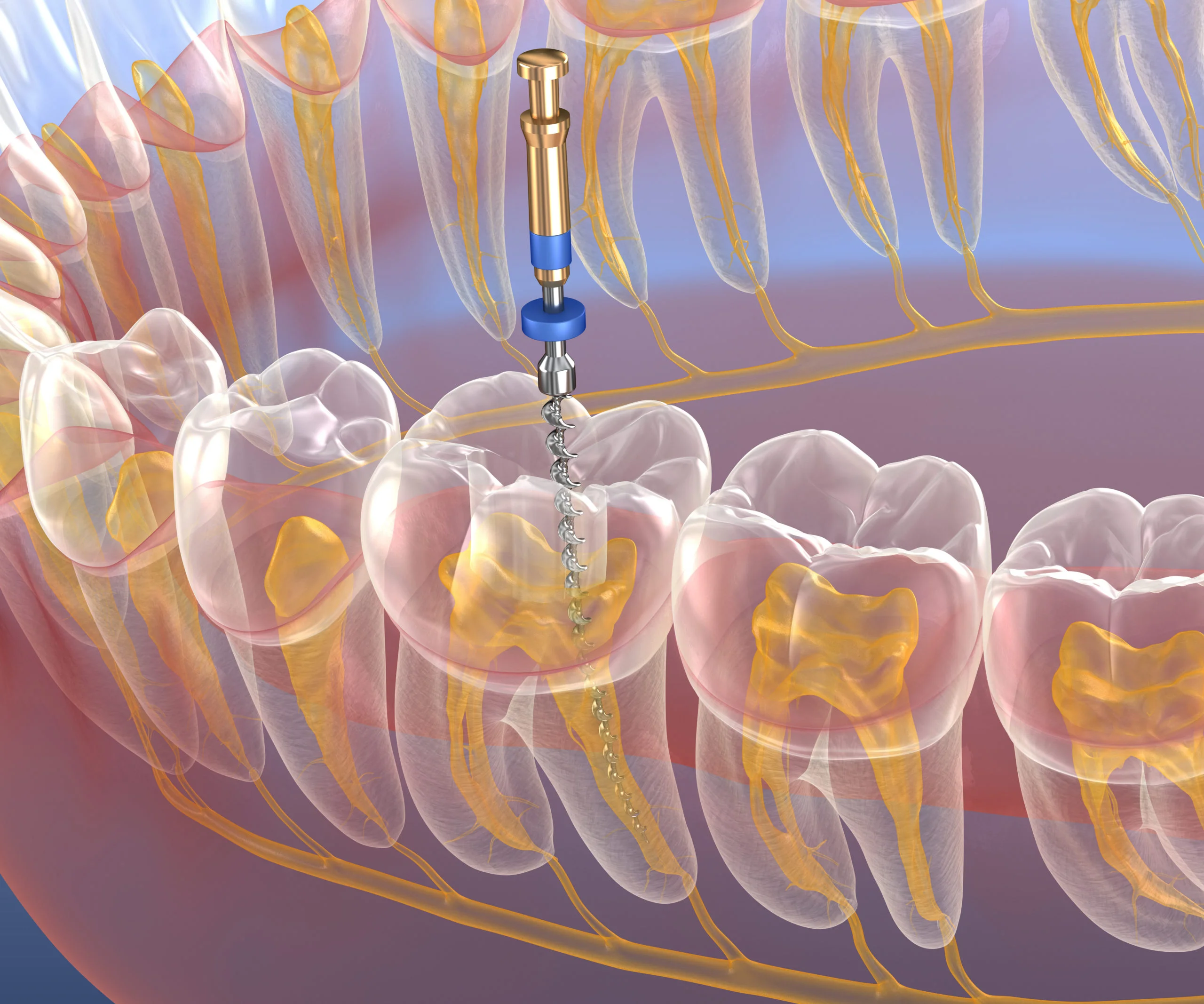 Endodoncia