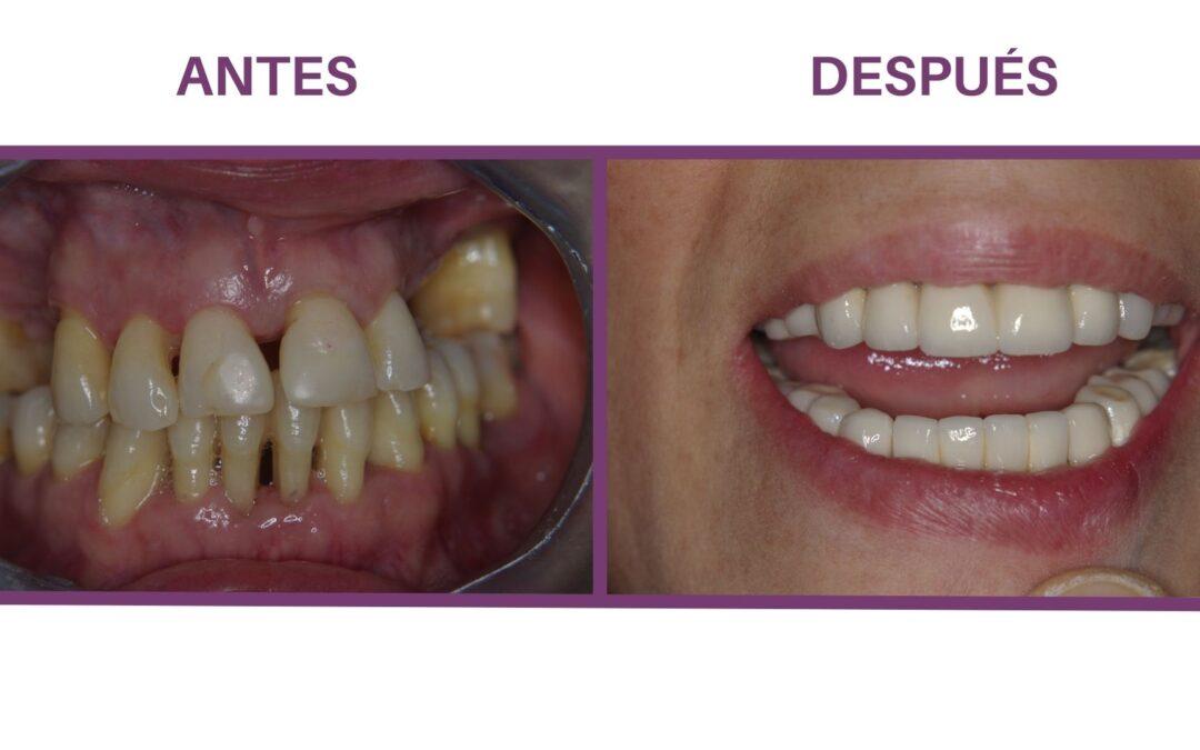 Periodoncia