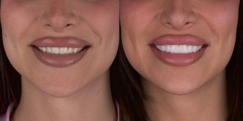 Sonrisas naturales